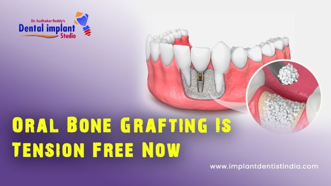 Oral bone grafting is tension free now at Dr. Sudhakar Reddy