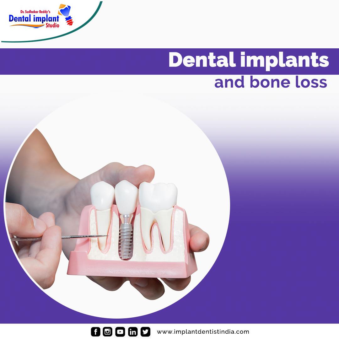 How Old Is Too Old To Get Dental Implants?