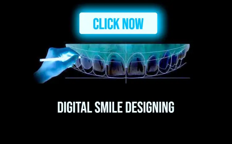 Smile designing