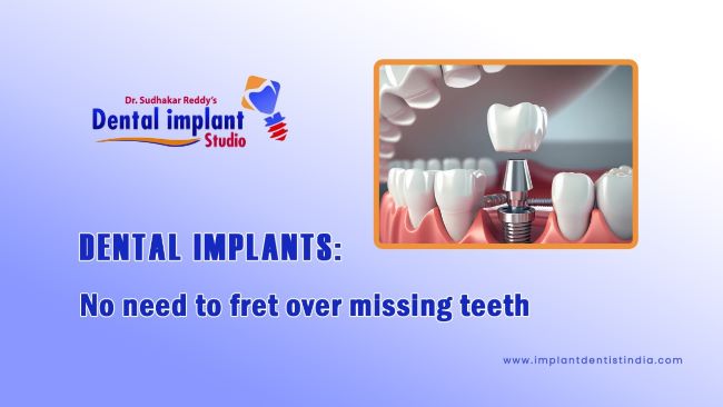 Dental implants: No need to fret over missing teeth