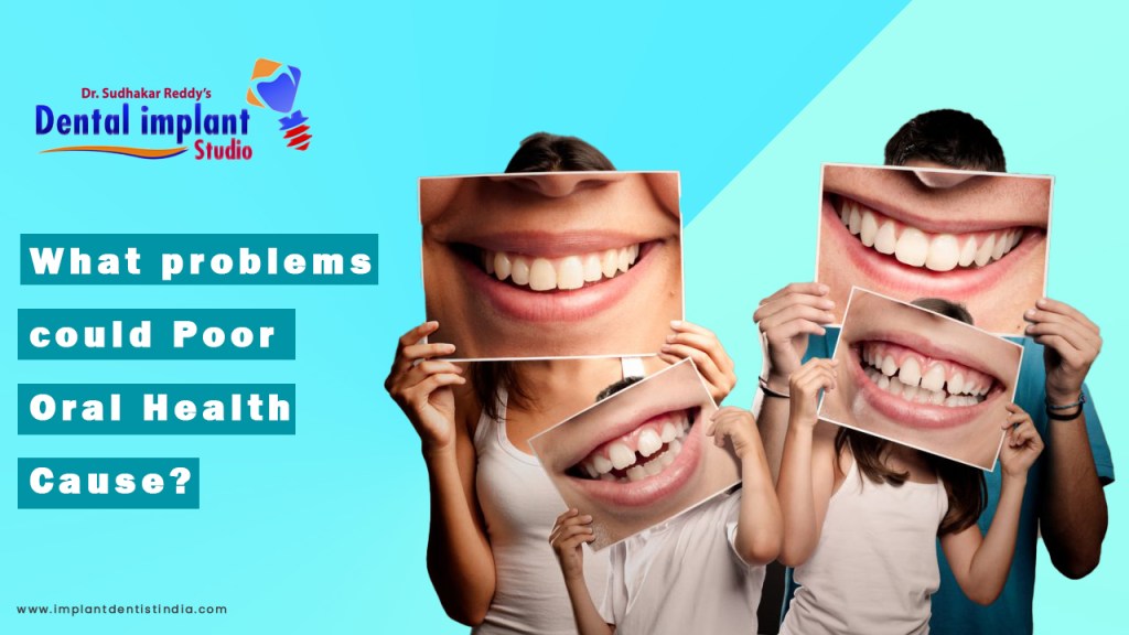 What Problems Could Poor Oral Health Cause ? at Dr. Sudhakar Reddy