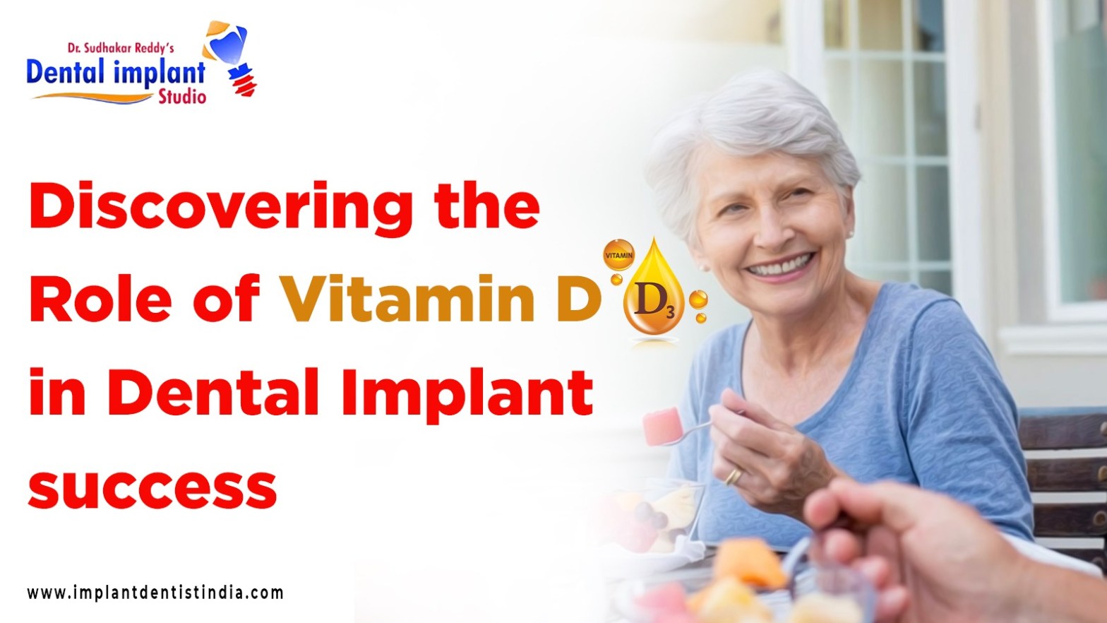 Discovering the Role of Vitamin D in Dental Implant success at Dr.Sudhakar Reddy