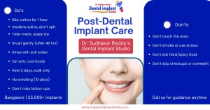 Post-Dental Implant Care : Do’s & Don’ts After Surgery at Dr. Sudhakar Reddy's Dental Implant Studio