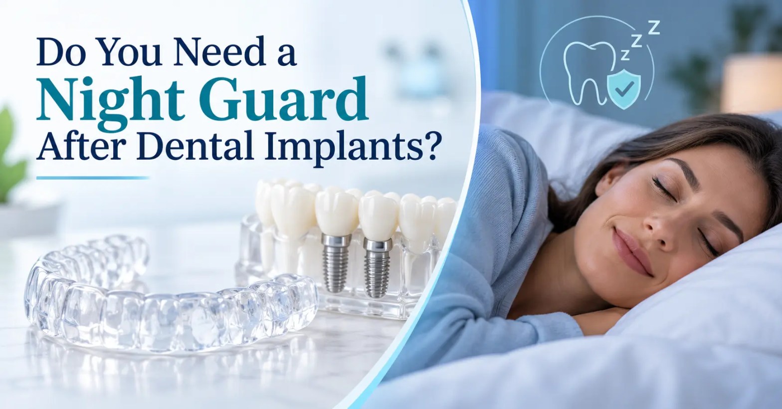Do You Need a Night Guard After Dental Implants?
